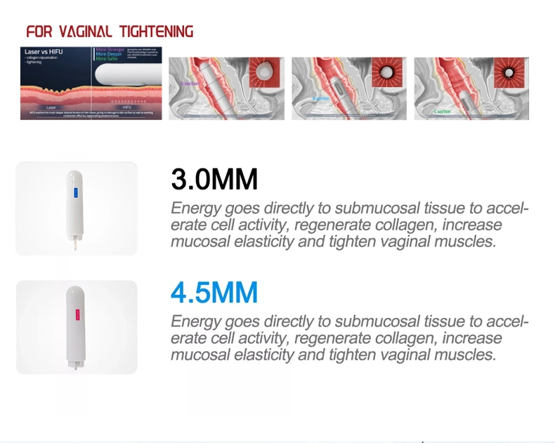 7D Face Lifting Hifu Vaginal Tightening Machine 7D Hifu