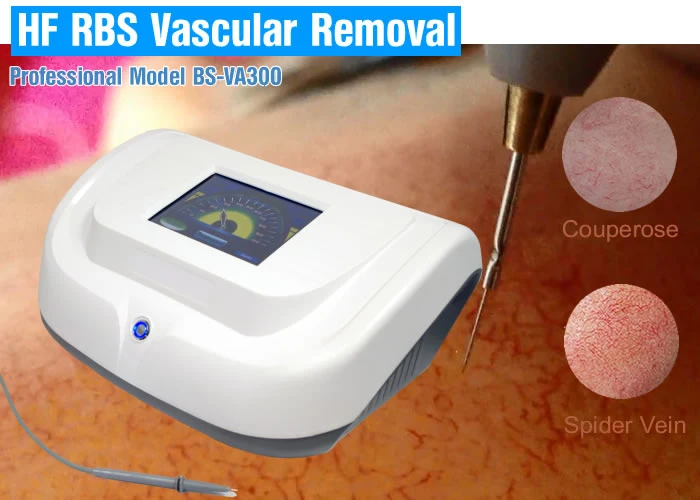 Hf Vascular Skin Tag Removal System