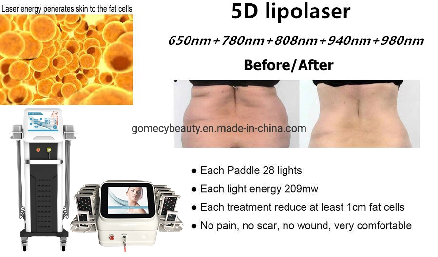 650nm 780nm 808nm 940nm 980nm Body Slimming 5D Lipolaser Lipo Laser