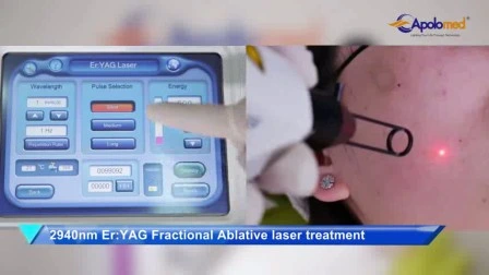 Dispositif laser de détatouage E-Light IPL RF ND YAG Laser Machine multifonction d'épilation de rajeunissement de la peau pour salon de beauté Centre SPA Hôpital Utilisation à domicile