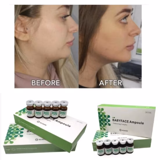 Hot Portable Hifu Ultrashape Vertical Amincissant Liposonix de perte de poids