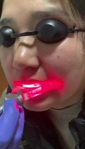 CE a approuvé la machine dentaire de laser de diode de maladie parodontale de blanchiment des dents 980nm